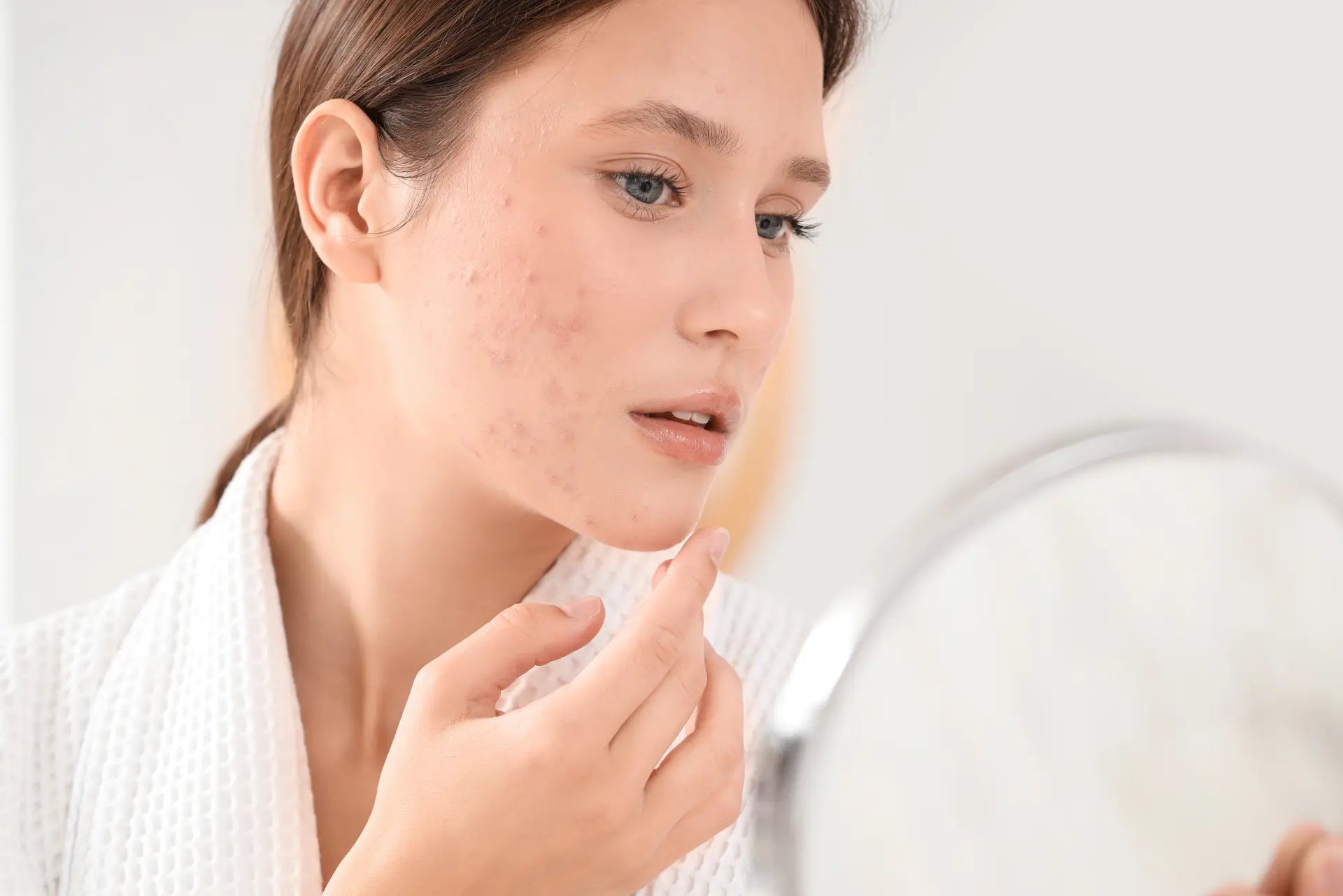 Ayuda con las Manchas